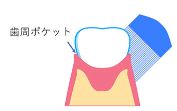 予防歯科 予防歯科